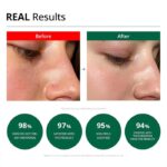 کرم آبرسان و تسکین دهنده رد بلمیش دکتر جی Dr.G Red Blemish Clear Soothing Cream